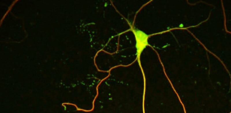 Identifican un nuevo regulador de la formación de neuronas