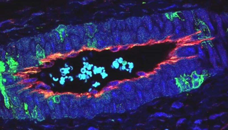La proteïna p38 regula la formació de nous vasos sanguinis en tumors