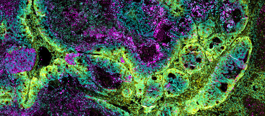 El IRB Barcelona adquiere un microscopio puntero y único en España