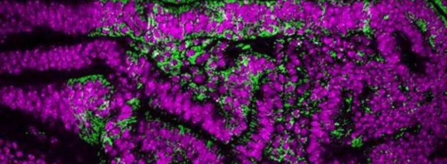 Researchers at IRB Barcelona reveal the link between chromosomal instability and cellular senescence