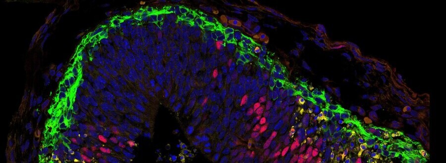 Key element identified in stem cell division and embryo development