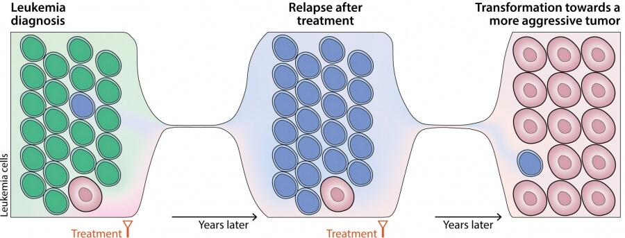 Leukaemia’s progression is already written from its onset at the time of diagnosis