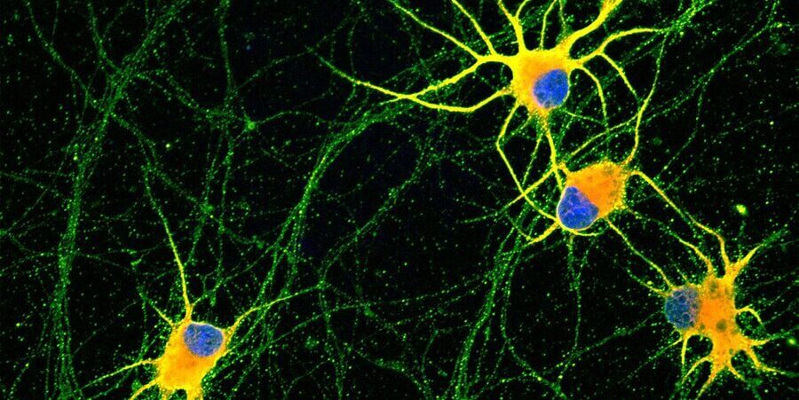 Aconsegueixen cultivar neurones madures per estudiar malalties neurodegeneratives