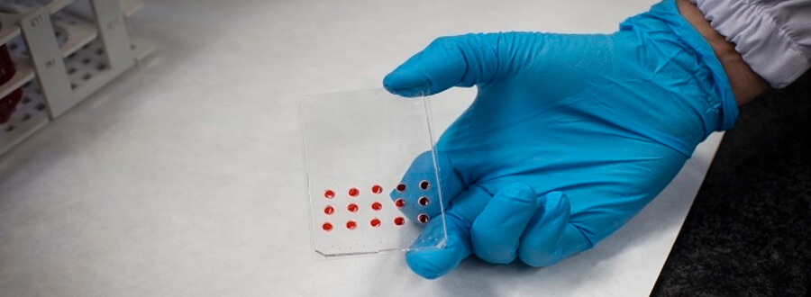 Researchers design a microfluidics device to predict cancer therapy response