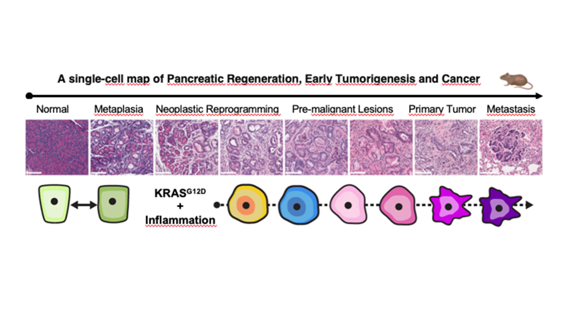 Cell-to-Cell signaling plays crucial role in early pancreatic cancer progression, study in mice reveals