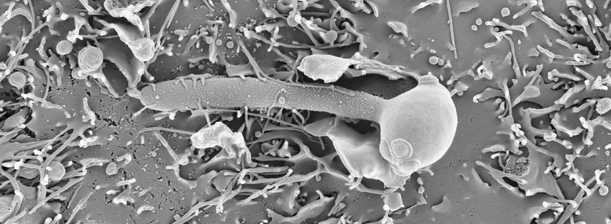 La evolución del hongo Candida al descubierto: nuevas perspectivas en las infecciones fúngicas