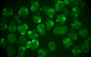 Imágenes de organoides de riñón (IBEC)