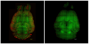 Light-sheet fluorescence microscopy images of a mouse brain 12 hours after being treated (right) or not (left) with nanoparticles.